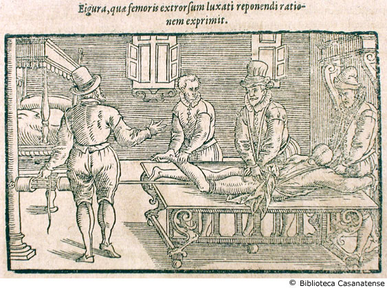 figura, quae femoris extrorsum luxati reponendi rationem exprimit (medico che esegue una trazione con una colonna di un letto), p. 343