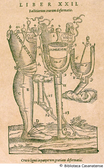 factitiorum crurum deformatio (protesi per gambe), p. 495 (prima figura)