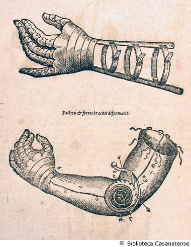 monstrat sequens figura externam manum factitiam, quaque ipsam liceat brachio vel manicae thoracis adnectere (figura in alto); Factii & ferrei brachii deformatio (figura in basso); (protesi di una mano), p. 494